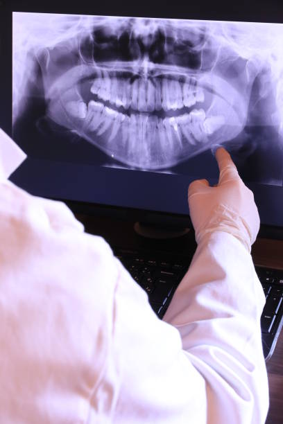 Best Emergency Dental Care for Broken or Chipped Teeth in Teays Valley, WV