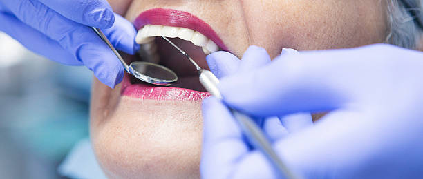 Best Emergency Treatment for Dental Infections or Abscesses in Teays Valley, WV